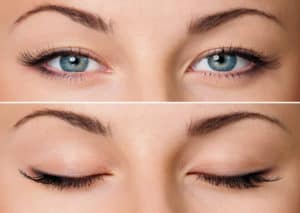 Blinking eyes for eye strain treatment