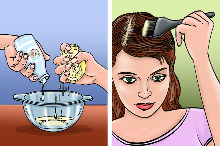 how to remove dandruff at home