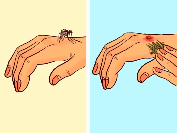 How to prevent mosquito bites while traveling