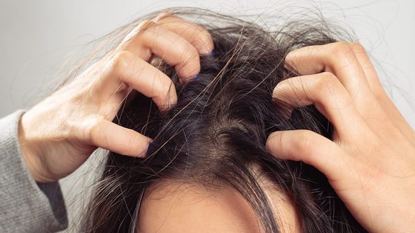 scratching head cause hair loss habit