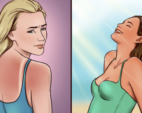 how to get rid of sunburn fast